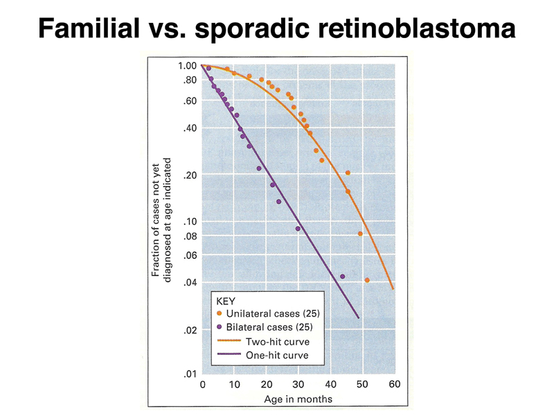 retinoblastoma